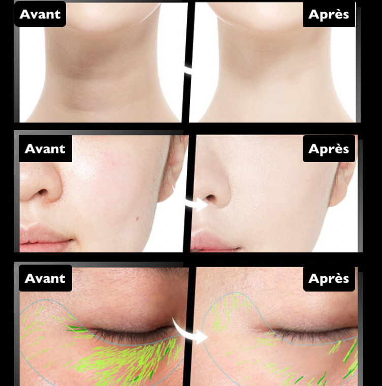 Ninalo™ - Microcurrent Face Lift Massager 